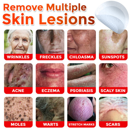🇨🇦✨GFOUK® MicroNeedle Botanic Skin Tag Removal Patch 🇺🇸 Made in the USA